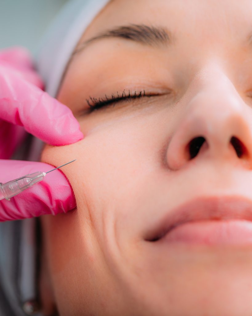 Naples Filler Treatments